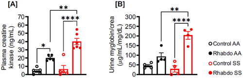 Figure 1. Glycerol-induced rhabdo is apparent in 5 h and aggravated in SS mice. Five hours after glycerol injection, plasma, and urine samples were harvested to measure rhabdo markers in AA and SS mice. (A) Plasma creatine kinase and (B) urinary myoglobin in control and rhabdo AA and SS mice (one-way ANOVA, with Holm-Šídák’s posthoc test).