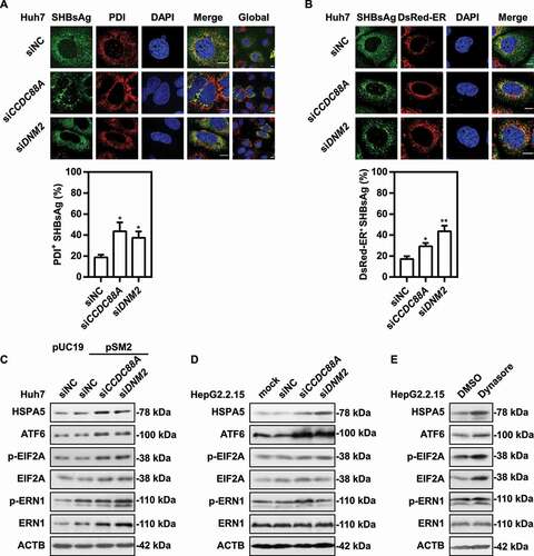 Figure 6. CCDC88A or DNM2 silencing causes SHBsAg accumulation on the ER lumen, thereby triggering ER stress. Huh7 cells were cotransfected with pSM2 combined without (A) or with (B) DsRed-ER plasmid, and siCCDC88A or siDNM2 for 48 h. The colocalization of SHBsAg and ER was imaged. Scale bar: 10 μm. The colocalization between SHBsAg and ER was analyzed using ImageJ software. The results presented in the graphs were calculated from at least 5 cells. (C) Huh7 cells were cotransfected with pSM2 or empty plasmid pUC19, and siCCDC88A or siDNM2 for 48 h. HepG2.2.15 cells were transfected with siCCDC88A or siDNM2 (D) or treated with dynasore (E) for 48 h. The expression levels of HSPA5, EIF2A, p-EIF2A, ERN1, p-ERN1 and ATF6 were measured.