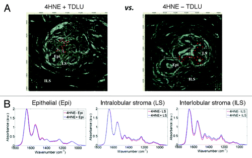 Figure 1. (A) Brightfield photomicrograph of representative terminal lobular ductal unit (TDLUs) in unstained breast tissue section from which infrared (IR) spectra were acquired from epithelial cells (E), intralobular stroma (LS), and interlobular stroma (ILS). Tissue sections used were selected from subjects at either end of the spectrum of immunostaining for 4-hydroxy2-nonenal (4HNE adducts) adducts.Citation43 Specifically, sections in the 4HNE+ category were from subjects whose breast tissue sections showed consistently a preponderance of TDLUs occupied by many 4HNE+ ME cells, while those in the 4HNE− category were from subjects whose tissue sections showed consistently at most a few TDLUs occupied by a small number of 4HNE+ ME cells.Citation43 4HNE− and 4HNE+ TDLUs were interrogated by synchrotron radiation-based Fourier-transform IR (SR-FTIR) microspectroscopy via a 10 μm × 10 μm beam aperture either to acquire point IR spectra or in a 10 μm step-wise fashion to derive image maps The red crosses identify locations from which point spectra were acquired one after another. The software used enables tracking along the brightfield image of the tissue section and pinpoint the exact locations from which spectra were derive spectra, i.e., along the epithelial cells. Once the points of interest are identified, the spectral acquisition program is activated, a motorized stage in chronological order moves each point of interest to the focus of the synchrotron IR beam to allow for spectral acquisition. (B) Average of all the IR spectra acquired from point IR spectra from 4HNE+ and 4HNE− TDLUs associated with E, LS, or ILS showing a typical wavenumber-absorbance intensity profile.