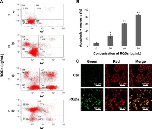 Figure 5 Induction of apoptosis in JEC cells following the RQDs treatment.Notes: (A) Cells were treated with different concentrations of RQDs for 24 hours, and stained with Annexin V-FITC and PI, and then apoptotic cells were quantified by flow cytometry. In order to quantify the apoptotic rate, different subpopulations were distinguishable: D1, Annexin V-negative but PI-positive, ie, necrotic cells; D2, Annexin V/PI-double positive, ie, late apoptotic cells; D3, Annexin V/PI-double negative, ie, live cells; D4, Annexin V-positive but PI-negative, ie, early apoptotic cells. (B) The apoptotic rate was determined as the percentage of D2 + D4.Citation28 (C) Mitochondrial membrane potential (ΔΨm) was analyzed using JC-1 mitochondrial membrane dye. JEC cells were treated with DMSO (control) or RQDs (15 µg/mL) for 24 hour. The drug caused an increase in the green (JC-1 monomers) and decrease in the red fluorescence (JC-1 aggregates), indicative of loss of ΔΨm. *P<0.05, **P<0.01.Abbreviations: RQDs, realgar quantum dots; PI, propidium iodide; DMSO, dimethyl sulfoxide; FITC, fluorescein isothiocyanate; ctrl, control; AV, annexin V.