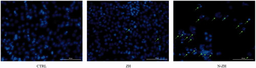 Figure 5. Morphological alterations in cell nuclei during ZH- and N-ZH-induced apoptosis in A549 cells, observed by DAPI staining and fluorescence microscopy. Scale bar, 100 µm. Zein hydrolysate (ZH), Nano-liposomal ZH (N-ZH).