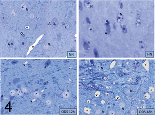 Figure 4. Pane illustrating 1 μm-thick epoxy thick sections of NN, HN, ODS12h and ODS48h from the ventral posterior nucleus thalamic region. Examples of some neuron cell bodies (N), astrocytes (A), oligodendrocytes (O), and myelinated tracts (M) are indicated throughout; in ODS12h and 48 h sections, myelinolysis neuropil cavities are marked (*) while other clear spaces, lined by endothelial cells are small blood vessels. Scales equal 10 μm