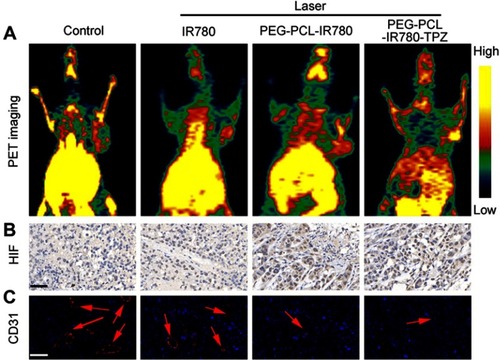 Figure 8 (A) Positron Emission Tomography (PET) images of mice recorded after treating with various treatments. (PBS, IR780+ laser, PEG-PCL-IR780+ laser, and PEG-PCL-IR780-TPZ + laser) (B) Hypoxia-inducible factor-1α (HIF-1α) staining for tumor tissues of different treatment groups. Scale bars: 50 μm. (C) Platelet endothelial cell adhesion molecule-1 (CD31) staining for tumor tissues of different treatment groups. The red arrows represented blood vessel. Scale bars: 50 μm.Abbreviations: PEG-PCL-IR780-TPZ NPs, polyethylene glycol- polycaprolactone-2-[2-[2-Chloro-3-[(1,3-dihydro-3,3-dimethyl-1-propyl-2H-indol-2-ylidene)ethylidene]-1-cycloxen-1-yl]-ethenyl]-3,3-dimethy-1-propyl-1H-indolium iodide-tirapazamine nanoparticles; PBS, phosphate buffer saline.