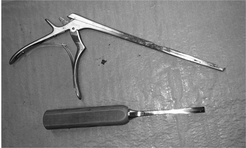 Figure 12. A Kerrison rongeur and a chisel are essential tools for performing laminectomy.