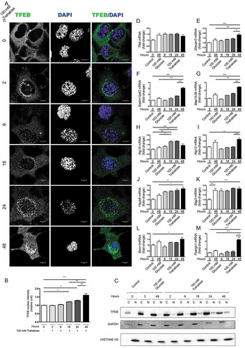 Figure 1. Trehalose activates TFEB nuclear translocation and induces protein quality control genes. (a-m) NSC34 cells were treated with 100 mM trehalose or glucose (as control) for different times. (a) IF analysis performed with anti-TFEB antibody (green), nuclei were stained with DAPI (blue) (63X magnification). Scale bar: 10 μm. (b) The bar graph represents the quantification of TFEB nuclear intensity; the fields were randomly selected and at least 100 cells for each sample were analyzed (n = 3) (*p < 0.05, ** p < 0.005, *** p < 0.001, one-way ANOVA with Tukey’s test). (c) WB analysis of cytoplasmic (C) and nuclear extracts (N). GAPDH and histone H3 were used as loading controls for cytoplasmic and nuclear fractions, respectively. (d-m) RT-qPCR analyses. The relative fold difference in mRNA expression was determined using t = 0 as internal control. Data are means ± SD of 4 independent samples. RT-qPCR on the following mRNA: Tfeb (d); Zkscan3 (e); Sqstm1/p62 (f); Map1lc3b (g); Atg10 (h); Atg12 (i); Hspb8 (j); Bag3 (k); Becn1 (l); Ppargc1A (m). Bar graphs represent the relative fold induction of these genes (*p < 0.05, ** p < 0.005, *** p < 0.001, one-way ANOVA with Tukey’s test).