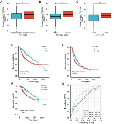 Figure 2 Overexpression of SLC39A1 correlates with poor survival and unfavorable clinicopathological characteristics in Hepatocellular Carcinoma (HCC). (A–C) SLC39A1 expression of HCC was significantly associated with TNM stage, Histologic grade, and alpha fetoprotein (AFP) level. (D–F) Kaplan-Meier analysis showed HCC patients with high expression of SLC39A1 had poor overall survival (D), progression-free survival (E) and disease specific survival (F) than those with low expression in TCGA. (G) ROC (Receiver operator characteristic curve) analysis showed that SLC39A1 was a reliable prognostic predictor in patients with HCC. *P < 0.05, ***P < 0.001.