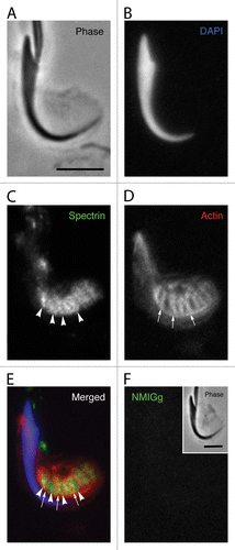 Figure 3. Localization of spectrin in a Sertoli cell apical process containing a late spermatid when analyzed using conventional fluorescence microscopy. The position of the spermatid head is clearly evident in the phase image (A) and when labeled with DAPI for DNA (B). Although the probe for spectrin generally labels in a diffuse pattern in the area adjacent to the concave face of the spermatid head, there are periodic linear tracts where the staining is more intense (arrowheads). These linear tracts appear similar to the labeling pattern for the actin networks of tubulobulbar complexes (arrows) (D); however, when the spectin and actin channels are merged, it is clear that the linear tracts of spectrin concentration actually appear between the actin networks of adjacent tubulobulbar complexes (E). No staining pattern similar to labeling with the spectrin antibody is present when the primary antibody is replaced with normal mouse IgG (F). Bars = 5.0 μm.