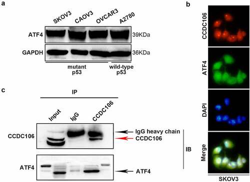 Figure 7. Functional regulation of CCDC106 and ATF4 in mutant p53 ovarian cancer cells. (a) Representative western blot analysis of ATF4 expression levels in ovarian cancer cells. (b) Colocalization of CCDC106 and ATF4 in SKOV3 cells by immunofluorescence. (c) CCDC106 binds to ATF4 in SKOV3 cells in immunoprecipitation results. All experiments were repeated three times with similar results.