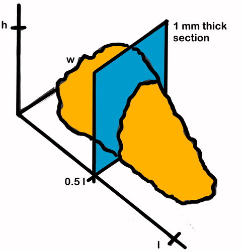 Figure 1. The standardized sampling of the longitudinal, adrenal midsection. h: gland height; w: gland width; l: gland length. Note that by this definition of midsection, it was not necessarily the point where the gland had the largest cross-sectional area.