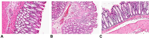 Figure 5 Effect of C60-Oil on DSS-induced colonic histological damage in Wistar rats. The mostly representative sections were selected for purpose of the demonstration. (A) Control; (B) DSS; (C) DSS+C60-Oil. (HE, 200×).