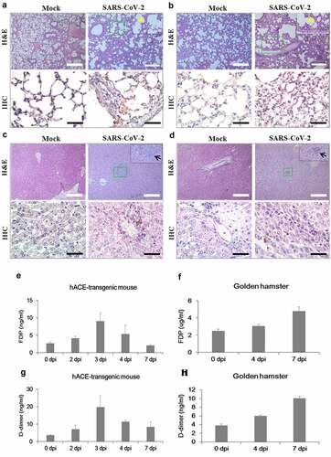 Figure 6. Histological examination, thrombosis, and viral replication in the hACE-transgenic mice and Syrian golden hamsters infected with SARS-CoV-2. (a-d) The representative images of the H&E and the IHC sections of the lungs (a, b) and the livers (c, d) of the 2-month-old hACE-transgenic mice (a, c) and 3-month-old Syrian golden hamsters (b, d) at 7 dpi of SARS-CoV-2 showing pathologies. Multifocal interstitial pneumonia with thickened alveolar septa (yellow arrows) and lymphoid cell aggregation (black arrows) are indicated in H&E staining. SARS-CoV-2 antigen expression is detected in the lung and liver in IHC for SARS-CoV-2-nucleocapsid (400 ×). (e, f) The levels of fibrin degradation products (FDP) in the plasma of the 2-month-old hACE-transgenic mice (e) and 3-month-old Syrian golden hamsters (f) at the indicated dpi (n = 3). (g, h) The levels of D-dimer in the plasma of the hACE-transgenic mice (E) and Syrian golden hamsters (F) after infection (n = 3). (i, j) The viral RNA levels in the primary organs, lung, brain, stomach, intestine, trachea, liver, blood, heart, kidney, and spleen, of the male hACE-transgenic mice (i) and the male Syrian golden hamsters (j) measured by RT-qPCR at the indicated dpi of SARS-CoV-2. Data are present as mean ± SD (n = 3). The scale bars represent 100 μm for 100 × magnifications