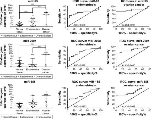 Figure 4 qRT-PCR validation in endometriosis and ovarian cancer patient cohort for miR-93, miR-141, miR-155, miR-429, miR-200c, miR-205 and miR-492. ROC curve analysis of expression levels of miRNAs for endometriosis and ovarian cancer group. The figure displays AUC for each evaluated miRNA, a parameter that indicates the precision in discriminating the endometrial tissue and ovarian cancer tissue from the normal tissue. *P<0.05; ***P<0.001.