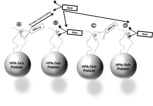 Figure 2 Cartoon depiction of autoantibody formation through somatic hypermutation of B-cell genes encoding IgG HPA-1a alloantibody (A). Autoantibody can bind platelets that are HPA-1a+ (B) or platelets that are. HPA-1a-negative (D), whereas HPA-1a antibodies can bind only HPA-1a+ platelets (A), but cannot bind and clear HPA-1a-negative platelets (C).