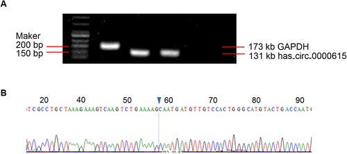 Figure 1 Validation of the presence of has_circ_0000615 in the plasma. (A) Agarose gel electrophoresis of qPCR products for has_circ_0000615; (B) the Sanger sequencing of the amplified product for has_circ_0000615.