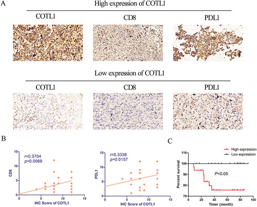 Figure 11 Correlation between COTL1 expression and immune infiltration, as well as prognosis in LGG. (A) Representative IHC staining of LGG tissues indicating both COTL1-high and low expression, with the presence of positively stained CD8 and PD-L1 expression cells. Scale bars, 20um. (B) The correlation of COTL1 with CD8 and PD-L1 protein expression in LGG were evaluated by Pearson’s correlation. (C) The Kaplan-Meier survival curves for OS of patients with LGG based on the expression status of COTL1.