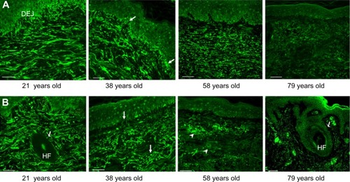 Figure 4 Age-related change of the MAGP-1 protein in human skin biopsies.