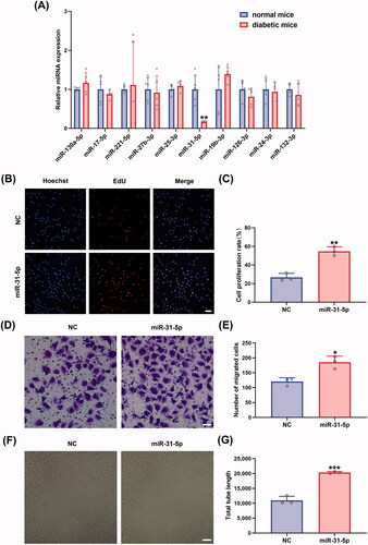 Figure 2. Overexpression of miR-31-5p promoted endothelial cell proliferation, migration, and angiogenesis. (A) Relative expression levels of miRNAs in wound tissue compared between normal mice and diabetic mice. n = 5, **p < .01 vs. normal mice. (B,C) EdU assay analysis of the proliferation rate of HUVECs treated with mimic-NC/miR-31-5p mimics. The proliferative cells and cellular nuclei were stained with red and blue colors. n = 3, **p < .01 vs. NC. Scale bar, 50 μm. (D,E) Images of migrated HUVECs in each group. n = 3, *p < .05 vs. NC. Scale bar, 50 μm. (F,G) Images of tube formation of HUVECs in each group. n = 3, ***p < .001 vs. NC. Scar bar, 100 μm. Data were presented as mean ± SD. Unpaired Student’s t-test was used.