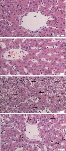 Figure 1. Effects of HP supplementation on liver histopathological changes in weaned pigs challenged by Escherichia coli lipopolysaccharide (LPS) (H&E staining, 400×). (A) Pigs fed with control diet and injected with sterile saline. The liver tissues showed normal morphology. (B) Pigs fed with HP dietary and injected with sterile saline. The liver tissues showed normal morphology. (C) Pigs fed with control diet and injected with LPS. The liver displayed obvious pathologic changes, including hepatic plate structure disorders, inflammatory cell infiltration (a), hepatocyte karyopycnosis (b), and karyolysis (c). (D) Pigs fed with HP and injected with LPS. Liver pathological changes were significantly ameliorated by dietary HP supplementation.