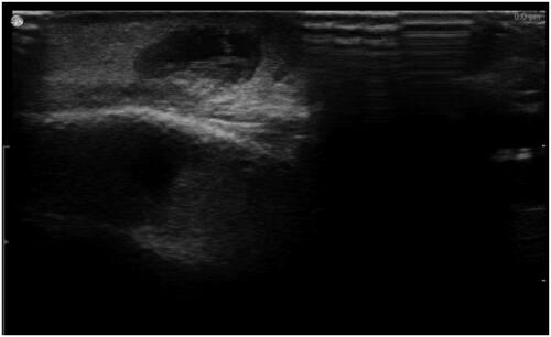 Figure 3. An ultrasound image of the motile nematode.