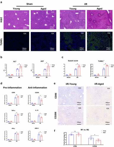 Figure 2. Aging aggravated liver injury and suppressed macrophage anti-inflammatory function in I/R‐stressed livers. Young and aged mice (n = 6 mice per group) were subjected to liver partial warm ischemia for 1.5 hr followed by 6 hr of reperfusion. HE and TUNEL-stained tissue sections of livers (a). Average levels of serum ALT and AST in mice (b). Suzuki’s scores based on liver H&E-stained sections and TUNEL-positive percentages evaluated by ImageJ software (c). Macrophage inflammation-related gene expression (CD86, TNF-α, IFN-γ, CD206, IL-10, ARG-1) was measured by qRT–PCR (d). CD86 or CD206 was detected by IHC in liver tissue sections post I/R (e), and percentages were evaluated by ImageJ software (f). Data are presented as the mean ± SEM and performed by one-way analysis, P values <0.05 (two-tailed) were considered statistically significant.