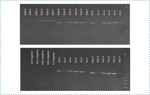 Figure 1. PCR products visualized on a 1.5% agarose gel stained with ethidium bromide.L: 100 bp DNA ladder.