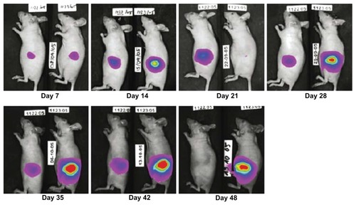 Figure 9 Examples of in vivo luciferase measurements, quantification, and generation of tumor growth curves, showing one animal from the control group (right) and one from the liposomal gemcitabine 8 mg/kg group (left). © 2007, Springer. Reproduced with permission from Bornmann C, Graeser R, Esser N, et al. A new liposomal formulation of gemcitabine is active in an orthotopic mouse model of pancreatic cancer accessible to bioluminescence imaging. Cancer Chemother Pharmacol. 2008;61(3):395–405.Citation56Notes: Overlays of a picture with the light signal encoded as a spectrum with red representing the most, and blue the least intense light, are shown. Tumor end-volumes were 0.45 cm3 (1,122), and 1.69 cm3 (1,123), respectively.