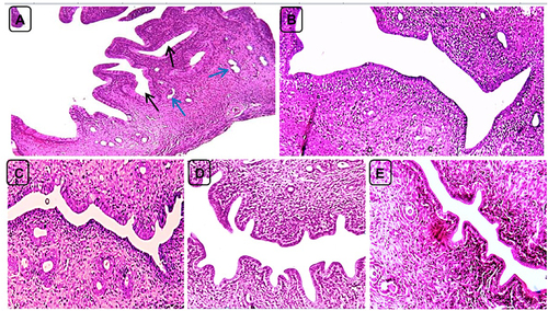 Figure 9 Uterine sections of positive control (PC) and treatment rats on day 40. (A) PC group showing marked endometrial hyperplasia with profound endometrial folds toward the uterine lumen and cystic dilatation (black arrows) and convolution (blue arrows) of the endometrial glands. (B and C) Groups 3 (treatment control, Met 300 mg/Kg) and 6 (combination of Sil 100 mg/Kg and Met 300 mg/Kg) showing approximately normal uterine morphology. (D and E) Groups 4 and 5 (Sil 100 mg/Kg and Sil 200 mg/Kg BW respectively) showing mild endometrial hyperplasia represented by short endometrial folds toward the uterine lumen. H and E, X200.