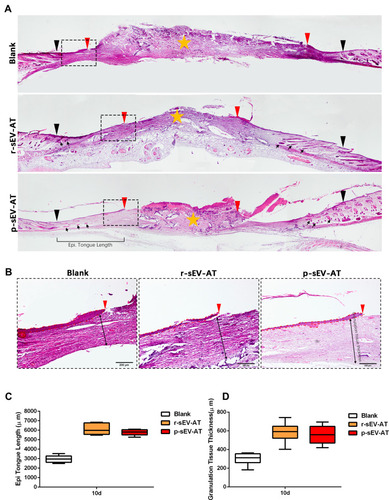 Figure 6 Skin wound healing in microstructure was improved by allogeneic and xenogeneic sEV-AT. (A) The microstructure of skin wounds at 10D was investigated by H&E staining. The black inverted triangles pointed out the original wound edges; the red inverted triangles pointed out the edge of re-epithelization; the black arrows pointed out the regenerated hair follicles; the orange star pointed out the disordered wound area. Magnified panels (B) the red inverted triangles pointed out the edge of re-epithelization; the dotted red lines pointed out the area of regenerated epithelium; the black two-way arrows pointed out the thickness of regularly arranged granulation tissue. Scale bar = 200 μm. (C) Quantification of the length of regenerated epidermal tongue at 10D. (D) Quantification of the thickness of granulation tissue at 10D (n=3).Abbreviations: H&E, hematoxylin and eosin; p-sEV-AT, small extracellular vesicles derived from porcine adipose tissue; r-sEV-AT, small extracellular vesicles derived from rat adipose tissue; sEV-AT, small extracellular vesicles derived from adipose tissue.