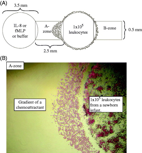 Figure 1. A: Schematic representation of the under-agarose migration assay. Wells are 3.5 mm wide and 2.5 mm apart. The two outer wells were loaded with 10 μL of 107 leukocytes/mL from a newborn infant or an adult (1 × 105 leukocytes/well). The central wells were loaded with IL-8 or fMLP or buffer (negative controls). By subtracting the number of neutrophils that migrated into the B-zone from the number in the A-zone, the number of neutrophils undergoing chemotaxis can be determined. B: An example of the migrating cells in the A-zone with 4× magnification, towards gradients of a chemoattractant. Note that only neutrophils have migrated into the A-zone at this time point.