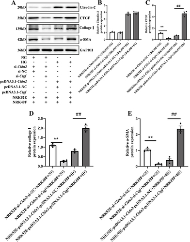 Figure 7 Claudin-2 deficiency induced tubular epithelial CTGF facilitates fibroblasts to product matrix protein. (A) Western blot demonstrated CTGF inhibition in NRK52E-si-Cldn2 cells decreased α-SMA and collage I expression in NRK49F cells, when the cells were co-cultured in 5.5mM D-glucose (NG) medium. Overexpression of CTGF in NRK52E-pcDNA3.1-Cldn2 cells increased α-SMA and collage I expression in NRK49F cells, when the cells were co-cultured in 30mM D-glucose (HG) medium. (B and C) The interference efficiency of Claudin-2 and CTGF protein expression in NRK52E cells were confirmed by Western blot analyses. Quantitative analysis of Claudin-2 and CTGF are shown above. (D and E) Quantitative analysis of α-SMA and collagen I in NRK49F cells are shown above. Data are expressed as mean data ± SEM (n = 3), **P<0.01, NRK52E-si-Cldn2-si-NC+NRK49F+NG; ##P<0.01, vs NRK52E-pcDNA3.1-Cldn2-pcDNA3.1-NC+HG.