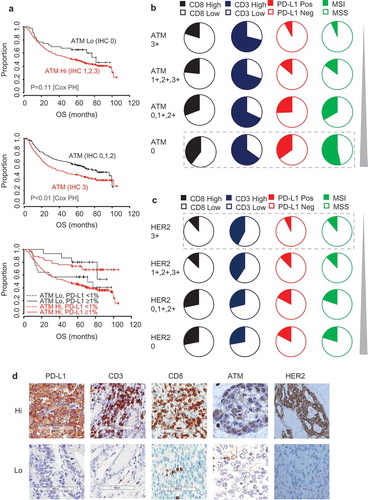 Figure 3. ATM-low and HER2-high segments are mutually exclusive and differ in their immune profile.(a) Kaplan-Meier estimates of overall survival (OS) according to ATM and PD-L1 TC stratification. Pie charts depict the frequency of patients with High and Low CD8, CD3 and PD-L1 TC densities and MSI status in (b) ATM and (c) HER2 populations. (d) Representative images for high and low examples of PD-L1, CD3, CD8, ATM and HER2. The cut-offs used were PD-L1 TC (≥ 1%), CD3 (500 cells/mm2) and CD8 (600 cells/mm2). Data were statistically analysed by Cox Proportional Hazards (*P < 0.05, **P < 0.01, ***P < 0.001).