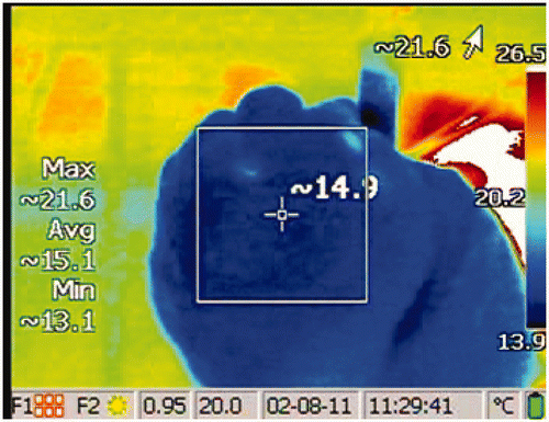 Figure 1. An example of surface temperature of the lung measured by infrared camera following a treatment. The values on the left describe the temperatures bounded by the square. The maximum lung surface temperature in this image is 21.6°C. The baseline temperature is subtracted from this maximum temperature to calculate the temperature change, examples in Figure 2.