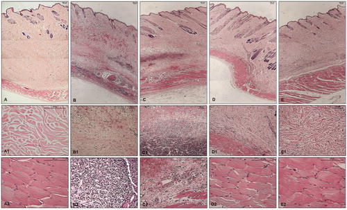 Figure 6. Histopathological analysis of skin fragments from rabbits inoculated with PBS, Loxosceles venom in the presence or absence of inhibitors 1, 5 or 6. Rabbit skin fragments inoculated with PBS, 5 μg of L. laeta venom in the absence or presence of inhibitors 1, 5 or 6 (1 μg), were removed 72 h after inoculation and fixed in 4% formaldehyde pH 7.4. Samples were submitted to the preparation of permanent histological slides stained with Hematoxylin-Eosin. (A) General appearance of the skin fragment inoculated with PBS (5× magnification). (A1) Detail of the collagenous area of the normal dermis (20× magnification). (A2) Detail of the normal adjacent muscular layer (20× magnification). (B) General appearance of the skin fragment inoculated with 5 μg of L. laeta venom in the absence of inhibitors (5× magnification). (B1) Detail of haemorrhagic areas and collagen disorganisation (10× magnification). (B2) Detail of the presence of dense inflammatory infiltrate in tissue (40× magnification). (C) General appearance of the skin fragment inoculated with venom in the presence of inhibitor 1 (5× magnification). (C1) Detail of the presence of inflammatory infiltrate and haemorrhagic areas in the tissue (10× magnification). (C2) Detail of the disorganisation of collagen fibres and haemorrhagic areas near the adjacent muscular layer (20× magnification). (D) General appearance of the skin fragment inoculated with venom in the presence of inhibitor 5 (5× magnification). (D1) Detail of reduced collagen disorganisation, absence of haemorrhagic areas and inflammatory infiltrate (10× magnification). (D2) Detail of the adjacent muscular layer (40× magnification). (E) General appearance of the skin fragment inoculated with venom in the presence of inhibitor 6 (5× magnification). (E1) Detail of reduced collagen disorganisation, absence of haemorrhagic areas and inflammatory infiltrate (20× magnification). (E2) Detail of the adjacent muscular layer (40× magnification). The slides were analysed and photographed using a Leica DM2500 microscope with the aid of Leica QWin Plus Y2.8 software.