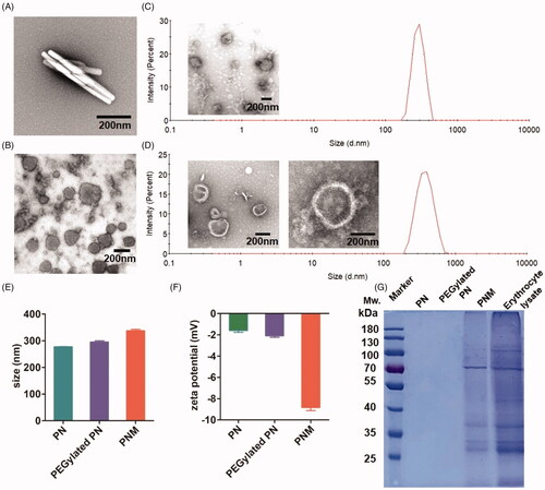 Figure 2. In vitro characterization of PN, PEGylated PN, and the PNM. (A) and (B) showed the morphology of nod-shaped PN and spherical-shaped PN by TEM, respectively; (C) and (D) represented particle size distribution of PEGylated PN and the PNM, respectively, measured by DLS and TEM; (E) Comparison of average particle size of PN, PEGylated PN, and the PNM; (F) Zeta potential of PN, PEGylated PN, and the PNM; (G) SDS-PAGE gel analysis of protein content in PN, PEGylated PN, and the PNM referred to RBC lysate; the error bars indicated ± SD (n = 3).