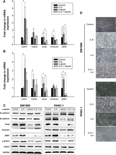 Figure 4 Luteolin reverses IL-6-induced EMT of PANC-1 and SW1990 cell lines.