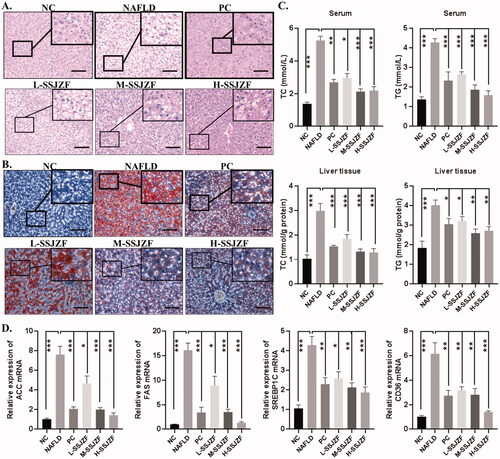 Figure 1. SSJZF treatment reduced hepatic lipid accumulation in rats with NAFLD (n = 6 per group). NAFLD: non-alcoholic fatty liver disease; SSJZF: Shen-Shi-Jiang-Zhuo formula; NC: normal control; PC: positive control; L-SSJZF: NAFLD rats treated with low dose SSJZF group; M-SSJZF: NAFLD rats treated with middle dose SSJZF group; H-SSJZF: NAFLD rats treated with high dose SSJZF group. (A) HE staining of rat liver tissues. Bar = 100 μm. (B) Oil red staining of rat liver tissues. Bar = 100 μm. (C) The content levels of TC and TG in serum and liver samples of rats were detected by an automatic biochemistry analyser. *p < 0.05, **p < 0.01, ***p < 0.001. TC, Total cholesterol; TG, Triglycerides. (D) The mRNA expression of lipid synthesis and uptake-relate genes (ACC/FAS/SREBP1C/CD36) in liver tissues were detected by RT-PCR. *p < 0.05, **p < 0.01, ***p < 0.001.