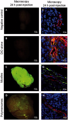 Figure 5. Macroscopic and microscopic (cryosection) fluorescent pictures of explanted HCT-116 tumors 24 h after retro-orbital injection in mice of 100 µL of PBS (A,E), DiO alone (B,F), micelles charged with 20% mol DiO (C,G), or polymersomes charged with 20% mol DiO (D,H). DiO fluorescence (green), and in cryosection nuclei stained with Hoechst (blue), and CD-31+ murine endothelial cells detected by immunofluorescence (red).