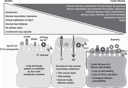 Figure 1 The pathogenesis of cystic fibrosis.