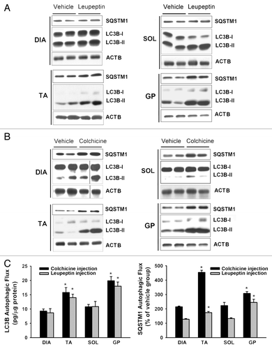 Figure 3. Autophagic flux measurements in control mice. (A and B) Representative immunoblots of LC3B and SQSTM1 proteins in DIA, TA, SOL, and GP muscles of mice in the vehicle, leupeptin and colchicine injection subgroups. Note relative increases in response to leupeptin and colchicine. (C) LC3B-II and SQSTM1 autophagic fluxes in DIA, TA, SOL, and GP muscles of control mice measured with the leupeptin and colchicine methods. *P < 0.05, as compared with DIA. n = 6 per group.