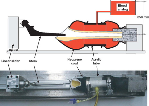 Figure 1. Apparatus to simulate physiological conditions during cement application and stem insertion. The femur was encased in a chamber created using neoprene and acrylic tubing. The proximal neoprene cowl was fixed to the femur using cyanoacrylate adhesive. The chamber was filled with a blood analog at 37°C and connected to an elevated reservoir, which raised the pressure to 3.5 kPa. Stem position was controlled by a sliding clamp.