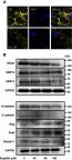 Figure 5 Eupatilin affects protein expression in EMT and RECK/MMP pathways. (A) Cell membrane of U251MG was stained with DiI (20 μM) for 30 mins after 24 hrs of treatment with eupatilin (wavelength: 555 nm). (B) Western blot detects the expression of related proteins in EMT and RECK/MMP pathways. GAPDH is used as a housekeeping protein to prove the equal loading in each lane of the electrophoresis and to normalize densitometric values of the other protein analyzed. Each experiment was repeated three times.