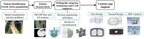 Figure 1. Process to reconstruction of the spine and design a custom cage implants.