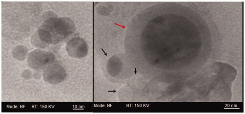 Figure 3. Transmission electron micrographs of a giant/bilamellar (gray arrow) and unilamellar (black arrow) curcumin-loaded T5m-liposomes in PBS, pH 5.7.