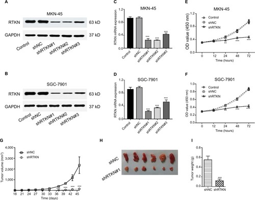 Figure 2 RTKN knockdown inhibited GC cell proliferation in vitro and in vivo.Notes: (A–D) MKN-45 and SGC-7901 cells were transduced with RTKN shRNAs (shRTKN#1, #2, or #3) or control shRNA (shNC) lentivirus. RTKN protein (A, B) and mRNA (C, D) levels were evaluated at 48 hours post transduction. Cells without any treatment served as negative control. (E, F) CCK-8 assay of MKN-45 and SGC-7901 cells transduced with shRTKN#1 (shRTKN) or shNC. In vitro experiments were performed three times independently. Data are presented as mean ± SD. Representative images for Western blotting are shown. (G–I) SGC-7901 cells stably transduced with shNC or shRTKN were subcutaneously injected into athymic nude mice (n=6 per group). Tumor diameter and volume (G) were evaluated for 46 days. At day 46, mice were sacrificed, and tumors were photographed (H) and weighted (I). **P<0.01, ***P<0.001 vs shNC.Abbreviations: CCK-8, Cell Counting Kit-8; GC, gastric cancer.