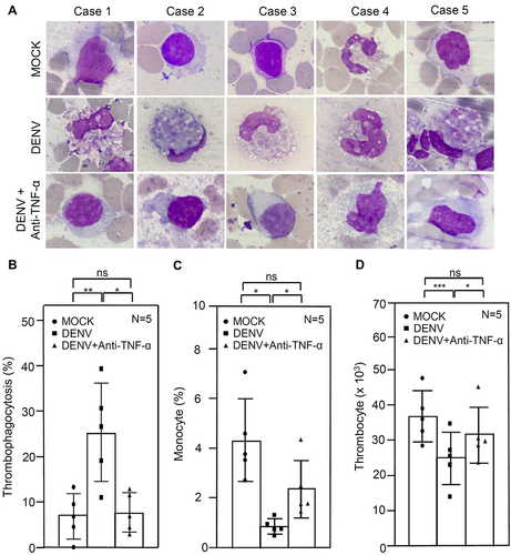 Figure 4 Exogenous administration of neutralizing TNF-α antibody reduces thrombophagocytosis and the loss of monocytes and thrombocytes. Following DENV (MOI = 1) co-culture in 100 μL of whole blood (WB) ex vivo without or with 50 μg/mL of neutralizing anti-TNF-α for 24 h, image analysis of Wright-Giemsa staining showed thrombophagocytosis (A). The percentages of thrombophagocytosis (B), monocytes (C), and thrombocytes (D) were calculated according to the results of Wright-Giemsa staining and CBC test accordingly. The quantitative data are depicted as the mean ± SD obtained from five cases (N = 5) and the representative image was selected from three microscopic observations in the fields. * p < 0.05, ** p < 0.01, and *** p < 0.001. ns, not significant.