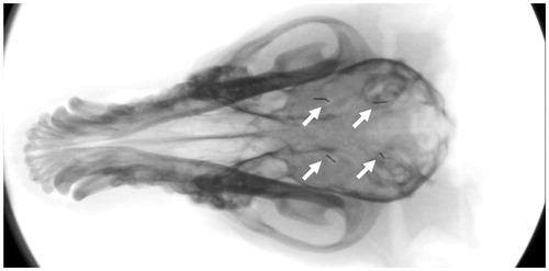 Figure 2. The four locations where hyperthermia was applied are indicated by fiducial markers (white arrows) in this X-ray image. The hyperthermia probe was placed through burr holes, penetrating ∼10–15 mm deep into brain tissue.
