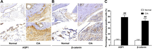 Figure 1 Immunohistochemistry assay for AQP1 and β-catenin expression in synovim of ankle joints from normal and CIA rats. Typical images of AQP1 (A) and β-catenin (B) expression in synovial tissues. High-power images (×400) show amplifications of regions boxed in blue in low-power images (×100). AQP1 and β-catenin were expressed at low levels in synovim from normal rats, whereas the relatively strong staining of AQP1 and β-catenin could be observed in CIA rats. (C) Percentages of AQP1 and β-catenin immune-positive cells in synovial tissues of normal and CIA rat. Data are mean ± SEM (n = 30). ##P < 0.01 compared with normal rat group.