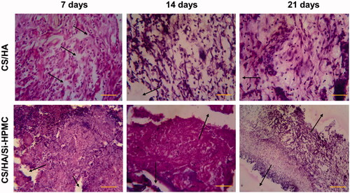 Figure 8. Histological sections of subcutaneous mouse tissue after implantation of CS/HA and CS/HA/Si-HPMC hydrogels for 7, 14, and 21 days and the strong integration (represented by arrows). (Scale bar = 100 μm).