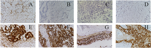 Figure 1 Expression of MSH2, MSH6, MLH1 and PMS2 proteins in CRC resection samples (IHC, ×400).