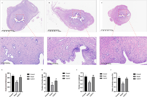 Figure 6 Histological analysis of rat uterus. (A–C) H&E staining results of uterine in the control, model and YJZYT groups (magnification: 40×). (D–F) The red areas represent magnification of H&E staining results. (G–J) Rat uterine wet weight, uterine organ index, thickness of the endometrium and number of glands. Data are presented as mean ± SEM; **Compared to the Control group, **P < 0.01. #Compared to the Model group, #P < 0.05, ##P < 0.01.